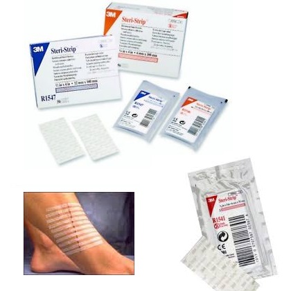 3M Steristrip Reinforced Closures | Steri Strips | FirstAid4Less 3M Steristrip Reinforced Closures | Steri Strips | FirstAid4Less